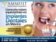 crown, bridges, coronas puentes dentistas tijuana, clinicas dentales