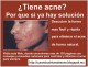 tratamiento para el acné - solucion rapida para el acne
