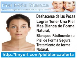 vick Avisos gratis en Mexico lindo en Nezahualc&oacute;yotl |  Como  hacer mi piel mas blanca � como blanquear mi piel, Blanquear su piel de forma segura natural y  permanente, en la comodidad de