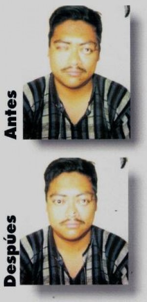 manuel guillen Avisos gratis en Mexico lindo en Cuauht&eacute;moc |  adaptacion y fabricacion  de protesis oculares con movimiento, PROTESIS OCULARES CON  MOVIMIENTO