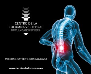 Centro de la Columna Avisos gratis en Mexico lindo en Alvaro Obreg&oacute;n |  hernias de disco, hernias de disco sin cirugia 
