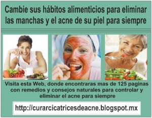 victor Avisos gratis en Mexico lindo en Texcoco |  Eliminar el acn&eacute; - tratamientos para el acne, Eliminar el acne de la cara 