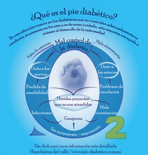 JR Avisos gratis en Mexico lindo en Gustavo A. Madero |  Pie diab&eacute;tico tratamiento con medicina hiperb&aacute;rica cura, Tratamiento con c&aacute;mara hiperb&aacute;rica
