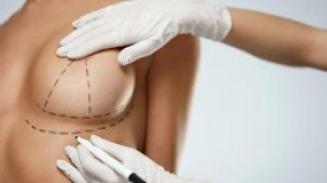 Dra. Isabel Caravant Avisos gratis en Mexico lindo en Ciudad de Mexico |  Cirug&iacute;a de aumento de senos con cirujano certificado, Operaci&oacute;n senos
