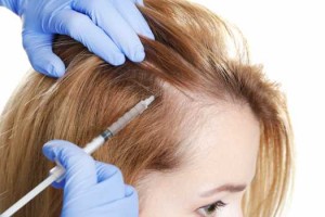 DHI Medical Global G Avisos gratis en Mexico lindo en Tijuana |  Tratamiento prp para la ca&iacute;da de cabello, Prp dhi