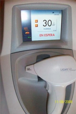  Avisos gratis en Mexico lindo en Monterrey |  vendo laser de depilacion light sheer diodo!!, ULTIMA GENERACION!!!
