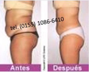 SUSANA CERVANTES Avisos gratis en Mexico lindo en Puerto Vallarta |  LA GRAN NATURISTA, PRODUCTO PARA BAJAR DE PESO SIN DIETA, CAPSULAS DE RAIZ DE NOPAL REFORZADAS CON RAIZ DE TORONJA CONCENTRADAS